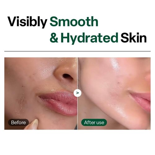 Dr. G Brightening Peeling Gel - Korean Exfoliator for Glowy Skin - Hyaluronic Acid & Vitamin C - 4.23 fl oz