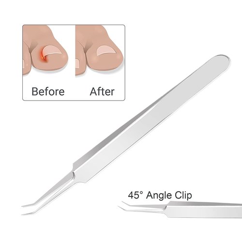 Ingrown Toenail Clipeprs, Toenail Clipper Straight Blade for Ingrown and Thick Nails, Ingrown Toenail Removal Kit include Tweezers, Ingrown Toenail File and Lifters (Black)