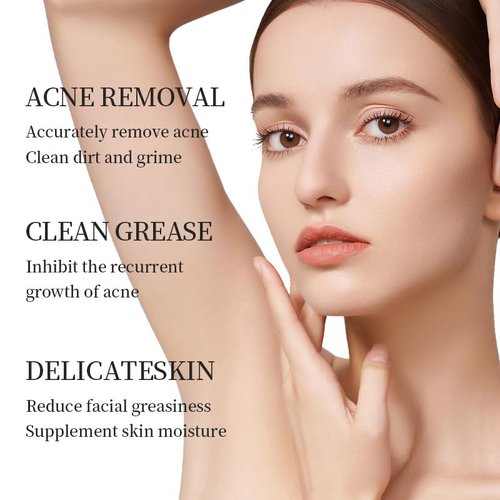 Regine Switzerland Azelaic Acid Acne Treatment Cream - 20% Glycolic Acid & Hyaluronic Acid, 20g