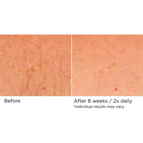 NassifMD Neck & Decollete Firming Complex - Lifting Formula for Youthful Skin