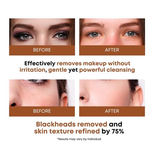 Skiennix Rice Water Cleansing Pads - Exfoliating Makeup Remover Wipes with Centella Asiatica | 50 Pads for Blackhead Removal & Pore Minimizing