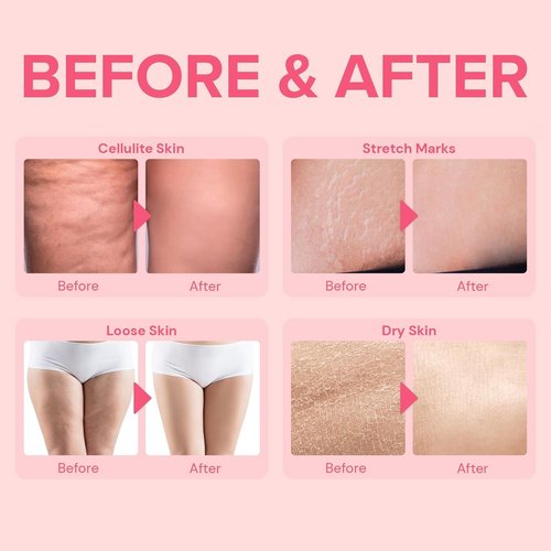 Enaskin Naturals Anti Cellulite Body Firming Cream: Cellulite Remover for Legs & Inner Thigh- Skin Tightening Lotion for Womens' Booty, Stomach & Belly with Acetyl Hexapeptide-8 & Caffeine, 100 ML