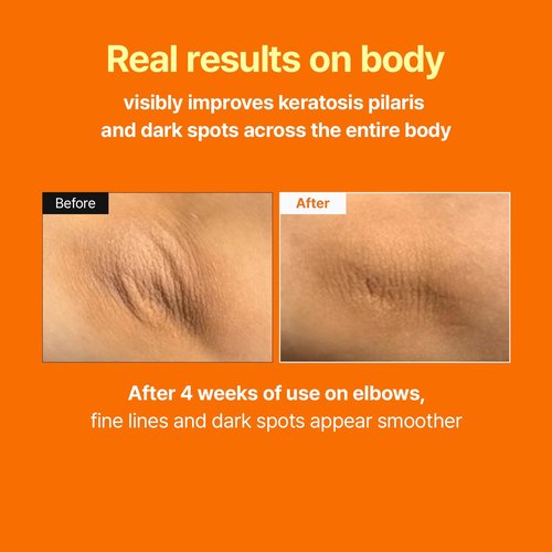 MEDITHERAPY Retinal Skin Booster Serum – Retinal for Beginners, Anti-Aging, Non-Irritating Daily Retinol for Face and Body – Pore Minimizer, Wrinkle Care – Korean Skin Care, 5.07 Fl. Oz Large Size