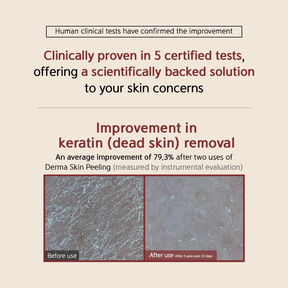 [BQCELL] [Made In Korea] [DERMA SKIN PEELING 2g / Recell Cure Serum 2ml, Safety Cap 1ea, 3set], Acne Skin Available, Exfoliating, Facial Scrub, Korean Beauty, Blackhead Remover