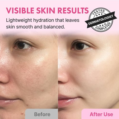 Hanskin Hyaluron Skin Essence Toner – Korean Hydrating Toner for Glass Skin | Hyaluronic Acid & Collagen | Lightweight Moisturizing Astringent for Dry, Sensitive & Dull Skin | K-Beauty (5.07 fl oz)