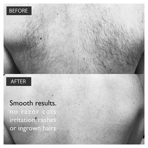 Bald Ape Parlour BALDAPE PARLOUR Body & Back Hair Removal Kit with Men's Depilatory Cream, Extendable Applicator & Loofah for Smooth, Hair-Free Results