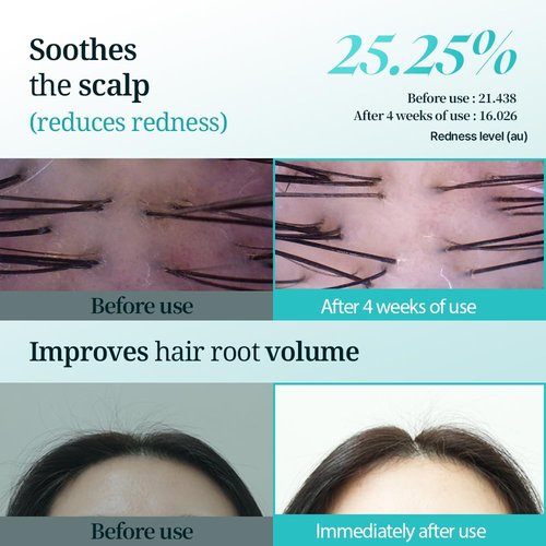 Hair Growth Shampoo for Hair Loss & Thinning | Clinically Proven DHT Blocker with Biotin, Caffeine & Panthenol | Hair Thickening Korean Shampoo | Hydrates Hair & Scalp | Sulfate-Free | 12.85 fl.oz.
