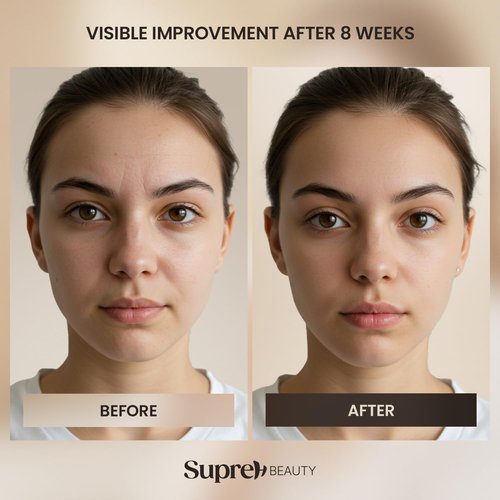 SupreH Bee Venom Cream Wrinkle Filler: Instant Face Lift Cream and Eye Tightener Cream with Hyaluronic acid Niacinamide for women and men 50 ML