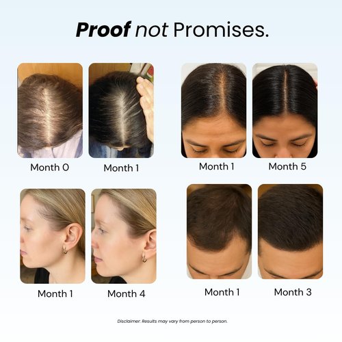 Growplex Revive Hair Strengthening Shampoo - Biotin, Caffeine & Rosemary for Thicker Hair - 250ml