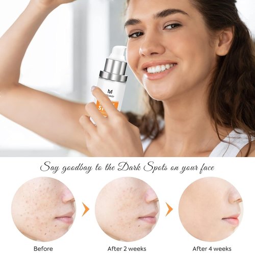 Regine Switzerland Dark Spot Remover - 5% Niacinamide Fade Cream for Sun Spots & Freckles | Anti-Aging Moisturizer for All Skin Types
