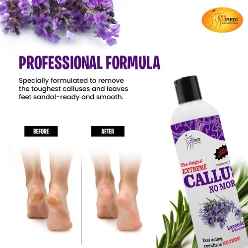SPA REDI Callus Remover - Professional-Grade Callus Dissolving Treatment - Stop Scraping. Start Dissolving. Chemically Dissolve Toughest Buildup for a Dramatic 'Wow' Transformation 12 Oz