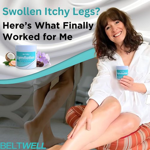 Beltwell® Lymflotion Non-Greasy Moisturizer for Dry & Sensitive Skin Relief – Fragrance Free Anti-Itch Lotion for Itchy Skin, Lymphedema, Diabetes, Eczema, Cracked Feet & Arms – 200ml