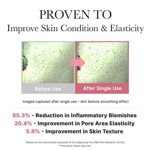 ARENCIA Red Smoothie Lotion 5, Face Moisturizer with Niacinamide 5%, Collagen, Peptide Complex, Hydrating Skin Care, 6.76 fl oz