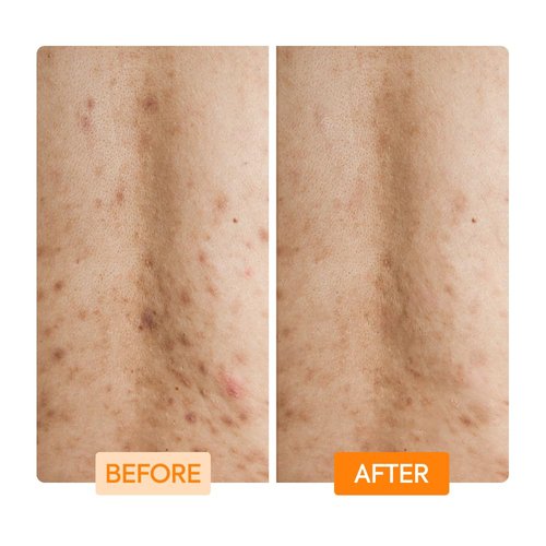 MAKARI IYKYK Gentle Exfoliating Body Wash | Glycolic & Lactic Acid Cleanser with Niacinamide | Smooths Dry Skin for Radiant-Looking Results | Vegan & Fragrance-Free
