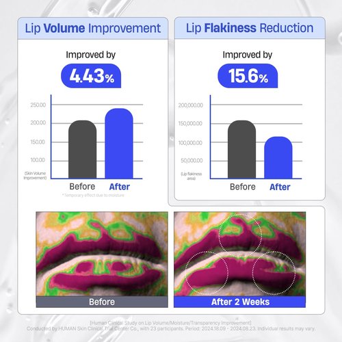 DERMATORY Hyalluron Peptide Lip Mask Balm - Hydrating Moisturizer for Day & Night Care (10ml)
