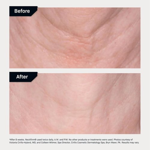 Revision Skincare Nectifirm® Neck Cream - Firm, Lift & Smooth Neck and Jawline | Brightens Skin & Reduces Aging Signs
