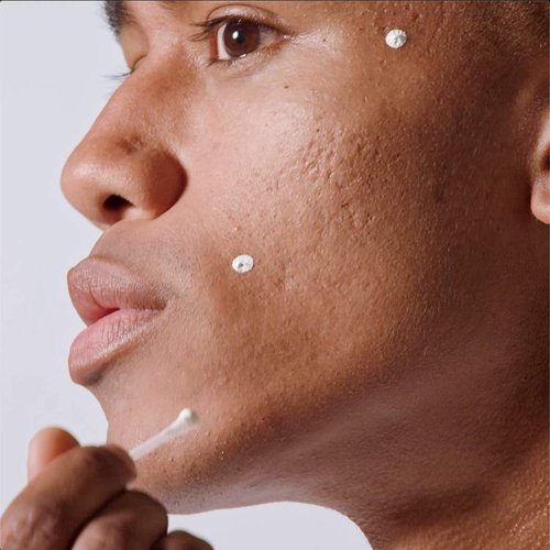 MALIN+GOETZ Acne Treatment - Overnight Spot Treatment with 10% Sulfur & Salicylic Acid | 0.5 Fl Oz