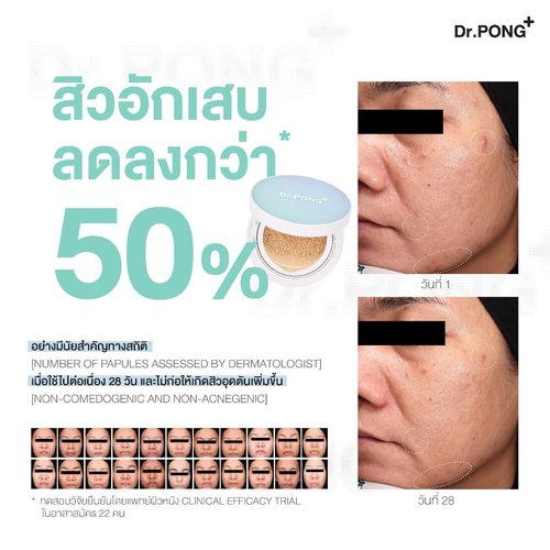 Dr.PONG ACNE ACE Longwear Cushion 15g (Light, 15)