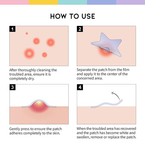 #OOTD Star Pimple Patches – Hydrocolloid Acne & Spot Patch for Face, Cute Pastel Colors, Niacinamide & Ceramide, K-Beauty Skincare – Stocking Stuffer for Teen Girls – 80 Count
