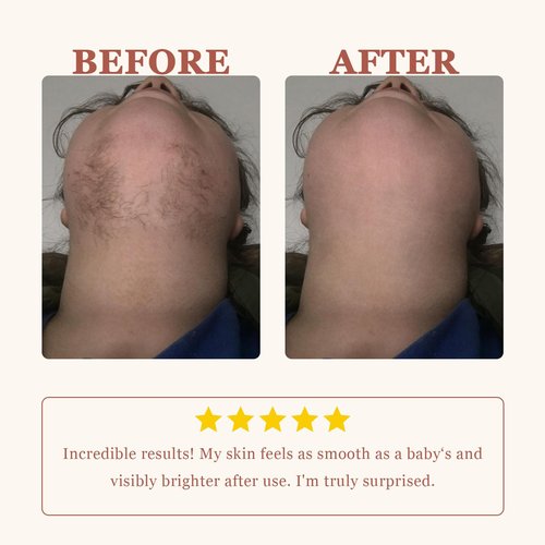 Face Hair Removal Cream for Women, Facial Depilatory Cream for Chin Upper Lip Sensitive Skin Hair Removal, Painless & Flawless Hair Removing At Home, 1.69 Fl.oz w/Spatula