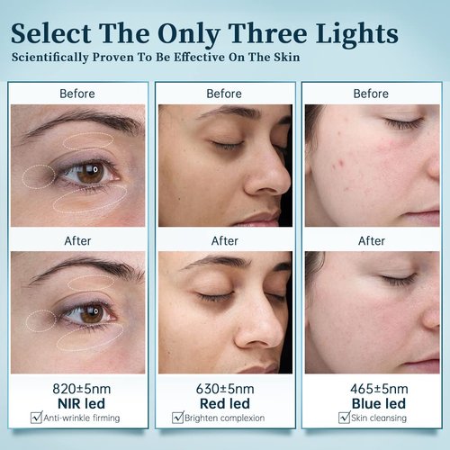 GYH LED Face Mask - Wireless Light Therapy for Anti-Aging | Red, Infrared & Blue Light, Cloud-S (RB-014)