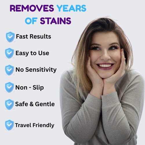 TobleMAX Teeth Whitening Strips – 14-Day Treatment, Non-Slip & Enamel-Safe, 10% Hydrogen Peroxide with Coconut Oil for Sensitive Teeth, Fast Stain Removal