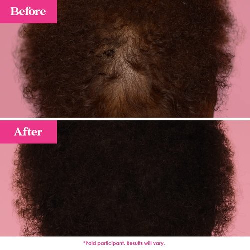 Grande Cosmetics GrandeHAIR Hair Enhancing Serum - Promotes Thickness for Thinning Hair | Safe for Color-Treated Hair