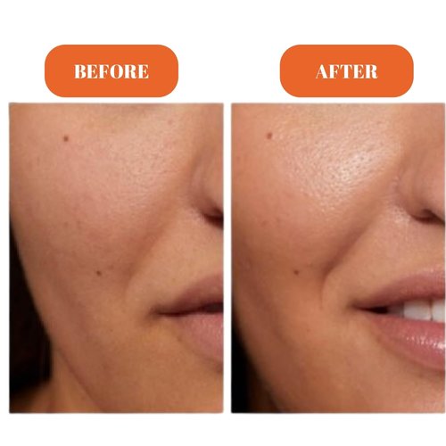 Radiance Maximising Vitamin C Serum - 10% Pure Stable Vitamin C Face Serum for Glowing Skin - Non-Sticky, Fast Absorbing Brightening & Anti-Aging Formula - No Pilling Under Makeup - 30ml