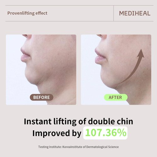 Mediheal Retinol Collagen Cream Lifting Mask - Anti-Aging V Line Treatment (10 Count) for Smooth Skin