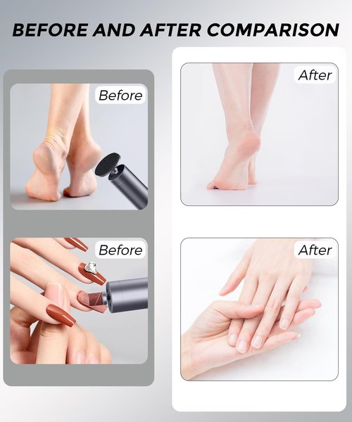 DAQVQ Electric Foot Callus Remover, 2-in-1 Cordless Pedicure Tools for Feet and Nail File with 80PCS Sandpaper Discs(3 Sizes), Aluminum Body with Adjustable Speed for Dead Skin, Cracked Heels & Home