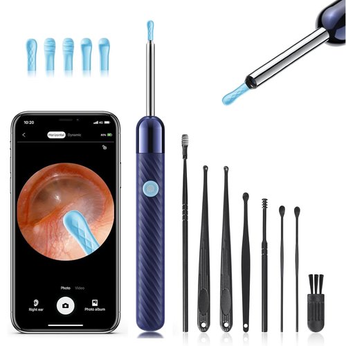 Loyker Ear Wax Removal, Ear Cleaner with Camera with 1080P, Otoscope with Light, Ear Wax Removal Kit with 6 Ear Pick, Ear Camera for iPhone, iPad, Android Phones (Blue)