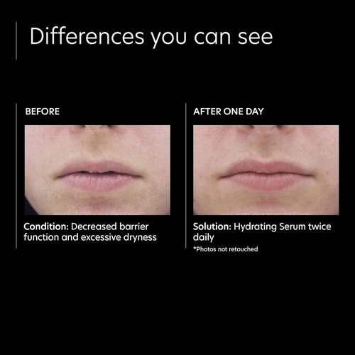 PCA SKIN Hydrating Serum - Nourishing Face Moisturizer for Sensitive Skin | 1 fl oz Pump