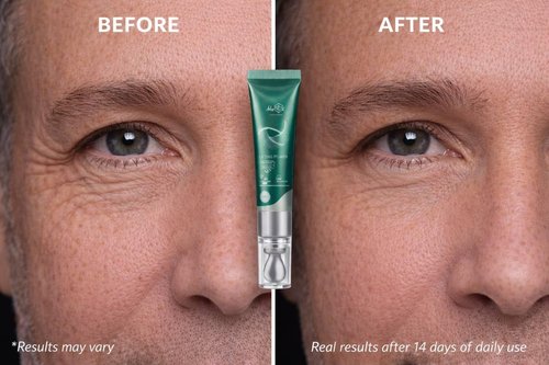 Skiennix Anti-Wrinkle Face Cream - Rejuvenating Peptide Moisturizer with 5 Peptides & Vitamins - 15ml