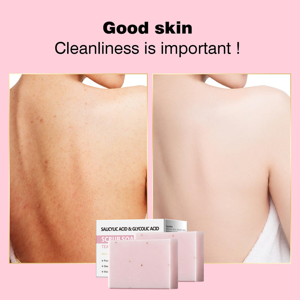 YAFUSIPE Salicylic Acid Scrub Soap, Face Bath Soap Bar with Glycolic Acid Tea Tree, Exfoliating Face Body Wash for Women & Men Anti-blemish Acne Strawberry Legs Ingrown Hair Keratosis Pilaris 200g/7OZ