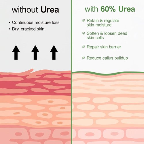 Regine Switzerland Urea Cream 60% - Maximum Strength Foot Lotion with Salicylic Acid & Tea Tree Oil | 5.29oz