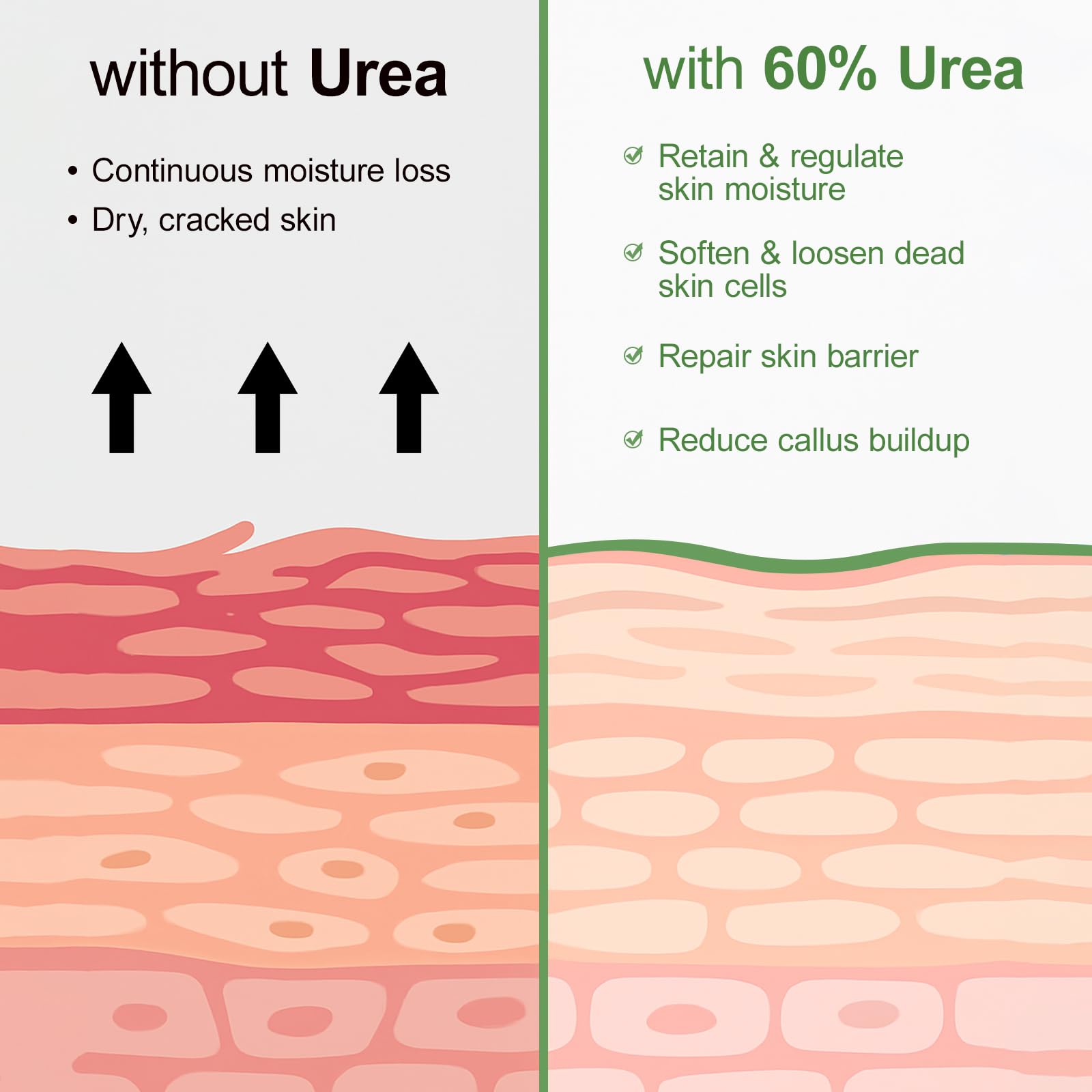 YAFUSIPE Urea Cream 60 Percent For Feet Maximum Strength Plus Salicylic Acid 2%, Tea Tree Foot Lotion For Dry Feet, Foot Cream Intensive Repair Foot Moisturizer 5.29oz