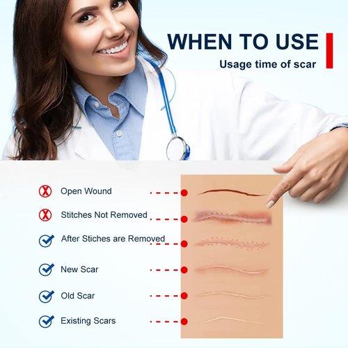 Silicone Scar Sheets Tape for Surgical Scars, C Section Scar Silicone Strips, Medical Grade, Reusable, Soften and Flattens Scars, Breast, Keloid, Professional Scar Patches. (1.6x115 Inch)