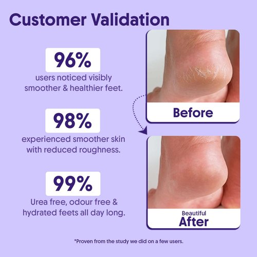 Aravi Organic 20% Urea Foot Roll-On for Dry, Rough & Cracked Feet | 0.5% Salicylic Acid, 5% Lactic Acid, 2% Glycolic Acid & 2% NMF Complex | Smooth & Soft Heels & Reduces Sweat - 1.6 FL Oz / 50ml