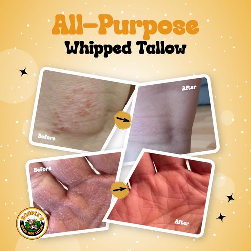 Magic Moo Whipped Beef Tallow Skincare - Organic Moisturizer for Acne, Eczema & Dry Skin | 4oz