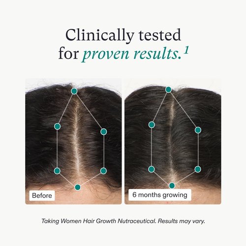 Nutrafol Women's Hair Growth Supplement - Physician-Formulated Collagen Peptides for Thicker Hair | 12 oz Bottle