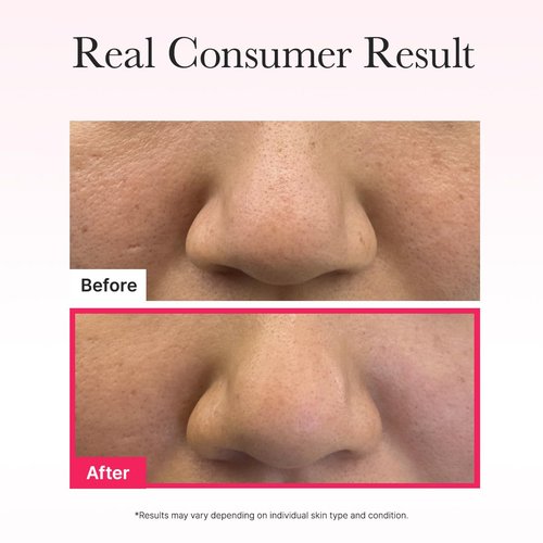ARENCIA Red Collagen Jello Mask - Plump & Hydrating Overnight Hydrogel Mask for Dry Skin | 4 Pack