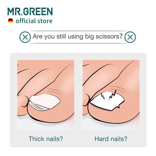 MR.GREEN Toenail Clipper Stainless Steel Ingrown Nail Cutter Good at Cutting Thick and Hard Nails Pedicure Tools (Purple+Nail Remover)