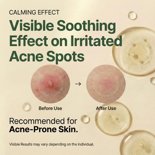 **Skiennix Centella Serum - Soothing Ampoule for Acne-Prone Skin | 30ml Unscented Formula**
