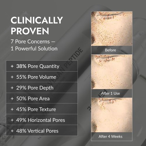 MIZON 7 Vegan Peptide Booster Serum Korean Anti-Aging Face Serum with Niacinamide & Hyaluronic Acid Hydrating Firming & Smoothing Skincare for Fine Lines & Skin Repair – 5.07 fl oz
