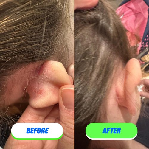 Pipa Skin Saver Hypochlorous Acid Spray for Face & Body 60 ml | Head to Toe Daily First Aid Skin Repair Spray for Sensitive Skin | Helps Reduce Eczema, Irritations, Rashes, Acne, Redness & Breakouts