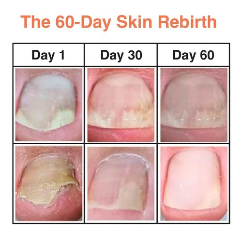 Fermented Nail Oil for Cuticle & Nail Repair | Vegan K-Beauty Serum with Herbal Extracts | Natural Strengthening & Moisturizing Formula for Brittle, Dry Nails | Nourishes, Smooths, Restores | 8ml