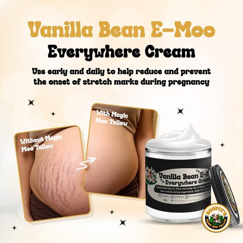 Magic Moo Beef Tallow Vanilla Bean E-Moo Moisturizing Everywhere Suet Tallow Cream with Organic Emu Oil. For Acne, Stretch Marks, Eczema, Hydration, Dry Skin & More! 2oz