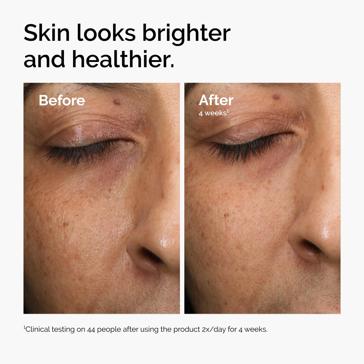 The Ordinary Multi-Antioxidant Radiance Serum - Vitamin C Face Serum for Brightening & Protection | 1 Fl Oz