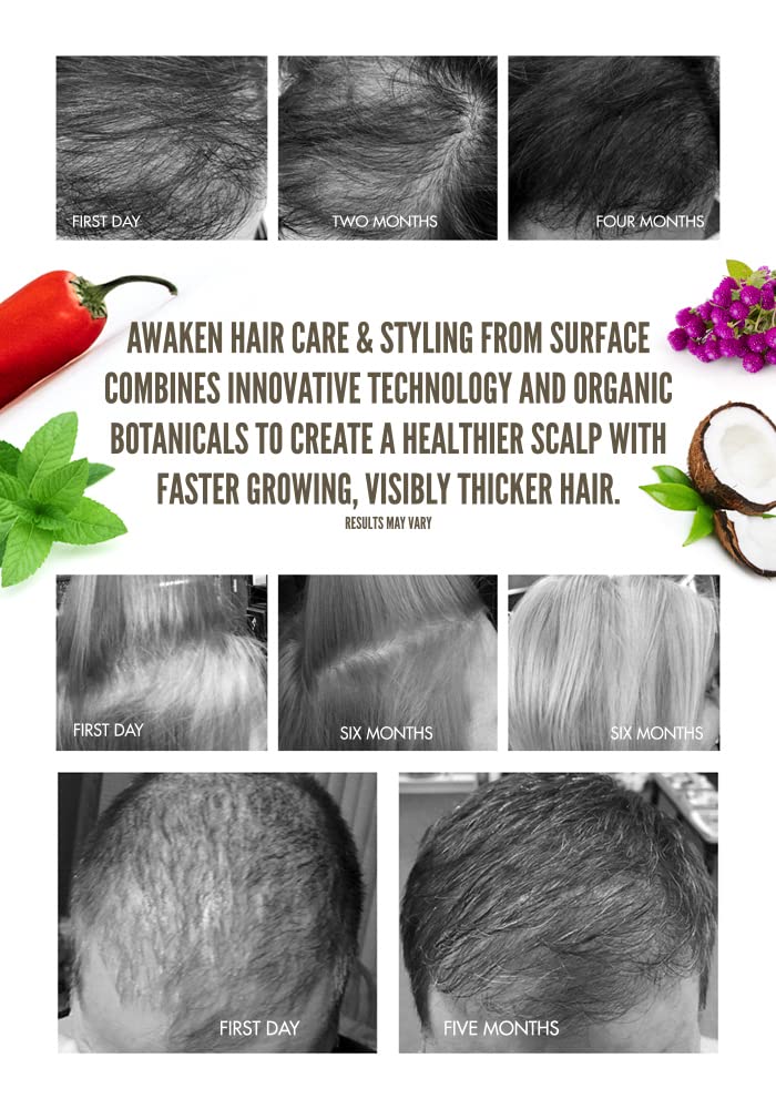 Surface Hair - Awaken Kit | Shampoo, Conditioner & Scalp Elixir for Thinning Hair & Hair Loss
