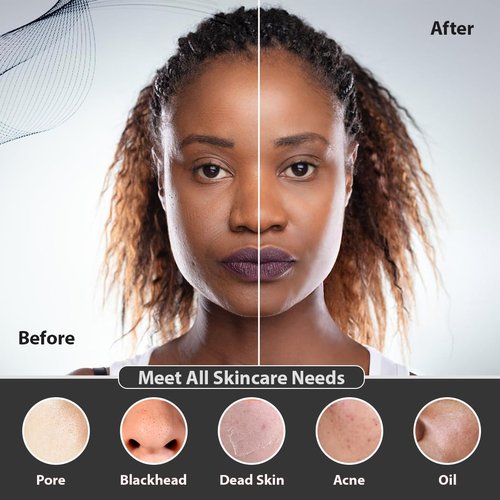 SC Chocolate Facial Cleansing Brush | 3-in-1 Electric Face Scrubber | USB Rechargeable Face Cleansing Brush | IPX7 Waterproof | Blackhead Remover | Deep Cleansing & Exfoliating (Black)